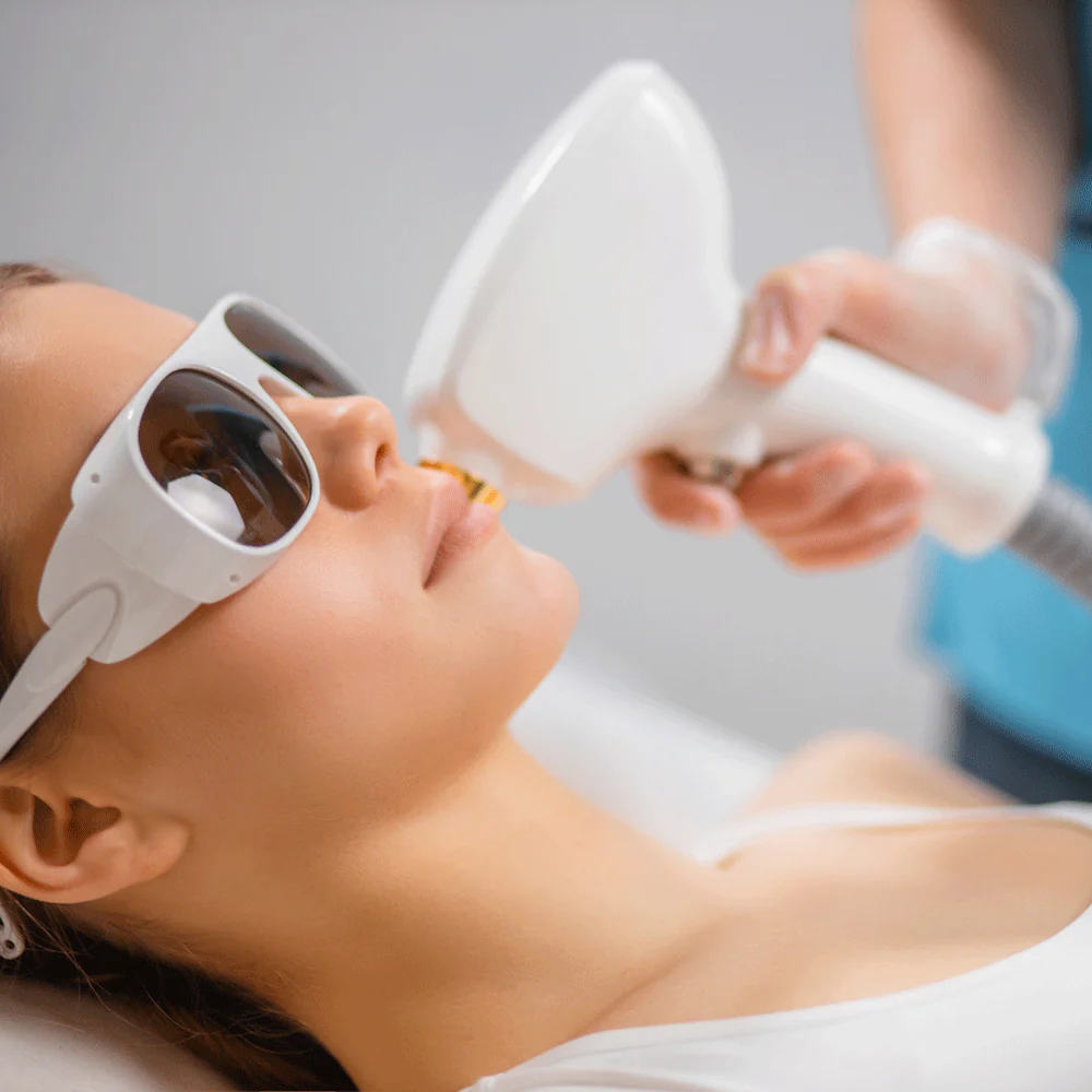 Laser Hair Removal in Dubai